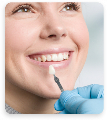 Facetas Dentarias