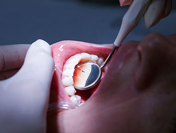 limpeza dental consultas
