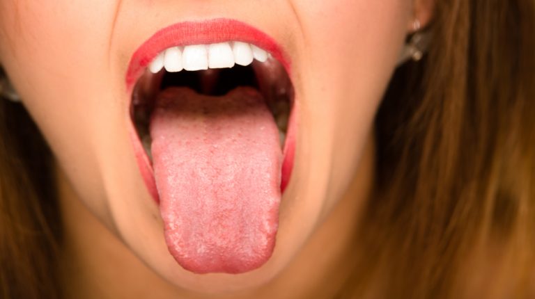 5 cuidados que você deve ter com a higiene da língua