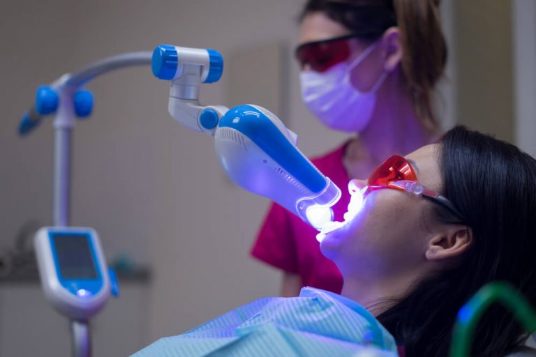Conheça o clareamento dental a laser