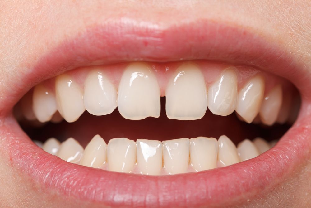 várias bocas em posições diferentes. com dentes, língua, sorriso