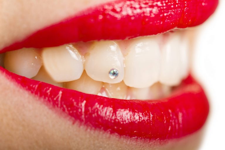 Descubra os tipos de piercing na boca e como cuidar - DentalVidas